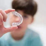 Achieving the Perfect Smile with Invisalign Aligners